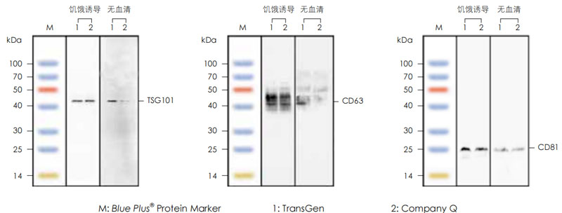 外泌體標(biāo)志性蛋白檢測(cè)